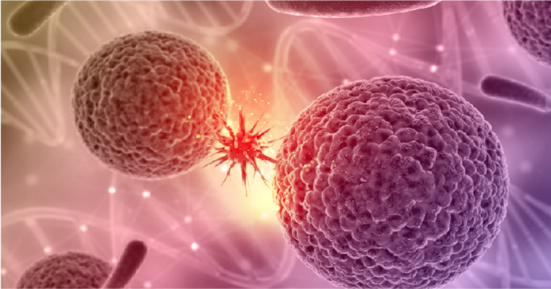 Lymphoma Cancer